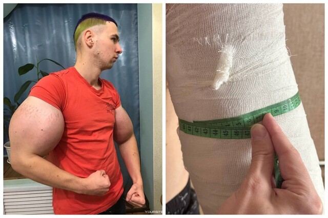 "Проблемы есть": псевдокачок Руки-базуки начал постепенно избавляться от синтола