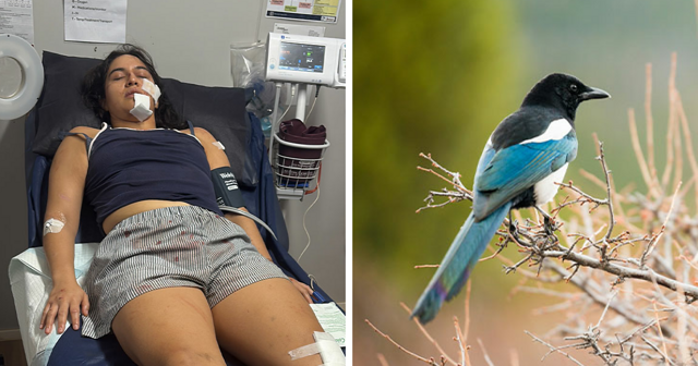 Женщине требуется операция после нападения сороки