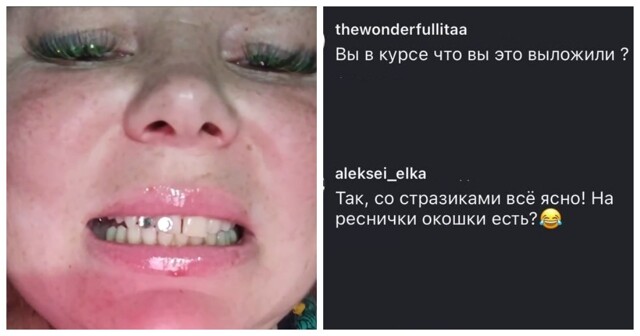 Когда денег на виниры нет, но блестеть хочется