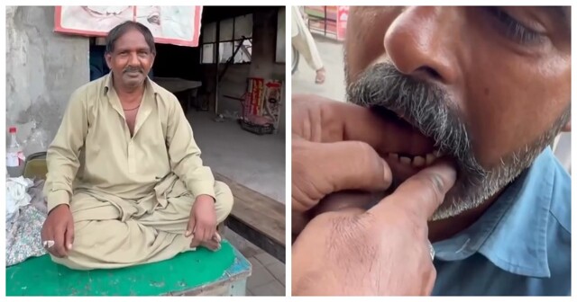 Шокирующая стоматологическая практика в Пакистане