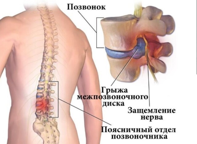 Всемирный заговор врачей. Раскрыт!  Касается каждого