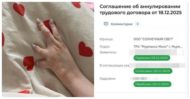 Девушку с инвалидностью уволили за «непрезентабельную» руку