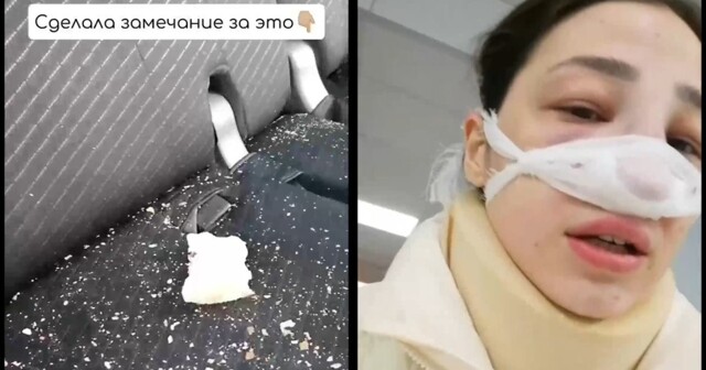 «Он&nbsp;держал, она била»: пьяная женщина сломала нос таксистке в&nbsp;Приморском крае