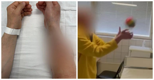 В России впервые провели успешную операцию по пересадке рук